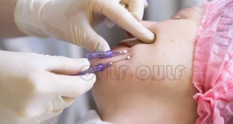 線雕最新手法，背景、發(fā)展、時代地位及展望